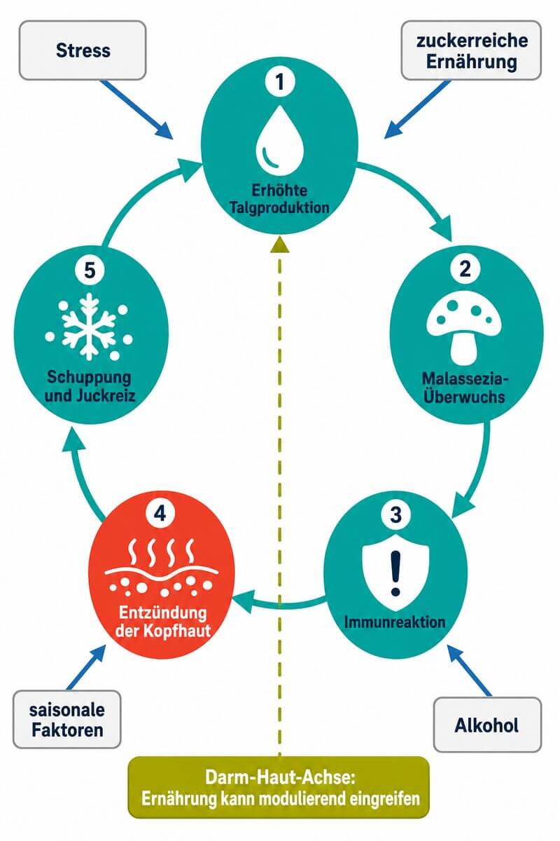 Infografik: Entstehungszyklus der seborrhoischen Dermatitis – Talgproduktion, Malassezia-Überwuchs und Entzündungsreaktion im Überblick.
